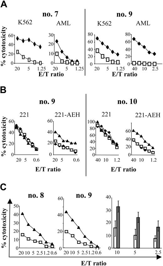 Figure 5. Cytolytic activity of NK cells after haploidentical SCT and inhibitory effect of CD94/NKG2A on NK cells. (A) Lower lysis activity by NK cells from SCT (□) than by NK cells from healthy donor (♦). NK cells from 2 patients were tested at engraftment (no. 7) or at 1 month after SCT (no. 9). NK cytolytic activity was tested against K562 target cells (K562) and mismatched primary AML targets (AML). Similar results were obtained with recipient primary AML blast. Primary AML blasts presented both distinct mismatches; in HLA-Cw of the group 2/KIR2DL2 (no. 7) or in HLA-Cw of the group 1/KIR2DL1 (no. 9). (B) Expression of HLA-E on target cells inhibited cytotoxicity of NK cells after haploidentical SCT by CD94/NKG2A. NK cells from 2 patients were tested at 3 months (no. 10) or at 1 month after SCT (no. 9) for cytotoxicity against LCL-721-221 target (221) or against LCL transfected by HLA-E (221-AEH; B2, B4). NK cells were incubated with media alone (♦), anti-IgG2b isotype control (□), or anti-NKG2A mAb (▴). Results are representative of 3 different experiments. (C) Cytotoxicity of NK cells from haploidentical SCT against primary leukemic AML blasts was restored by blocking NKG2A. (Left) Activated NK cells from 2 patients (no. 8, no. 9) were tested at 2 months after SCT for cytotoxicity against mismatched AML blasts. Primary AML blasts presented both distinct mismatches in Bw6/KIR3DL1/Cw group1/KIR2DL1 (no. 8) or Cw group 1/KIR2DL1 (no. 9). NK cells were incubated with anti-IgG2b isotype control (□) or anti-NKG2A mAb (▴). (Right) Percentage of lysis against mismatched AML blast at different effector-target (E/T) ratio. NK cells after transplantation were incubated with anti-IgG1 isotype control (□) or anti-NKG2AmAb (▦). Results show the mean of 6 different experiments and their standard deviation.