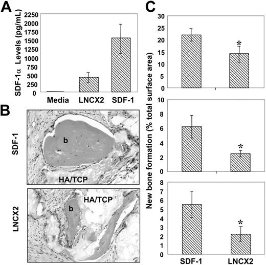 Figure 5. Enforced SDF-1 expression by BMSSCs enhances their osteogenic potential. (A) The retroviral packaging line PT67 was used to transduce secondary BMSSC cultures, derived from 3 different bone marrow aspirates, with a pLNCX2 construct containing either human SDF-1 cDNA or vector alone. Stable multicolony-derived high SDF-1–expressing BMSSCs and corresponding control lines were generated after G418 selection. Triplicate samples of tissue culture supernatant were assessed for SDF-1α levels using a commercially available ELISA kit. The data represent the mean values ± standard errors generated from 3 different high SDF-1–expressing BMSSC cell lines versus the corresponding controls. (B) Single-cell suspensions of each of the transduced BMSSC lines were mixed with hydroxyapatite (HA/TCP) particles and then implanted subcutaneously into NOD/SCID mice. The images represent cross-sections of 8-week-old harvested transplants of new bone (b) formed by high SDF-1–expressing BMSSCs (SDF-1) and control cell lines (LNCX2) stained with hematoxylin & eosin (× 200). Images were captured with an Olympus BX50 light microscope (Olympus, Tokyo, Japan) equipped with an Olympus D11 digital camera. Magnification ×200. (C) Each graph represents a different high SDF-1–expressing BMSSC line and corresponding control cell line derived from 3 different bone marrow donors. The level of new bone formation is expressed as a percentage of the total tissue surface area analyzed from 12 representative tissue sections, using Scion Imaging software. The data represent the mean values ± standard errors from duplicate transplants. Statistical differences (*) of P < .05 between the SDF-1 high-expressing BMSSC lines and corresponding controls were determined using the unpaired t test.