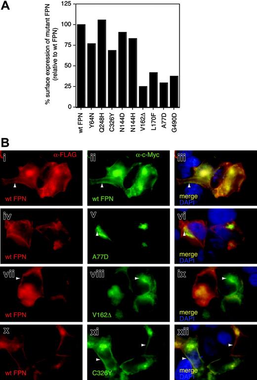 Figure 3. Cell-surface expression and intracellular localization of wtFPN and FPN mutants. (A) 293T cells were transfected with wtFPN–c-Myc and the mutant FPN–c-Myc variants indicated, and 2 days later stained for surface c-Myc tag and analyzed by flow cytometry for percentage of c-Myc–positive transfected cells and the MFI of the transfected cells (which is proportional to the amount of c-Myc expressed on the cell surface). The percentage of transfected cells did not vary significantly between wtFPN and mutant FPN constructs (70%-80% of cells were routinely c-Myc positive, not shown). However, the degree of fluorescence differed, with Y64N, C326Y, Q248H, N144D, and N144H all showing similar MFI comparable to wild type, while V162Δ, L170F, A77D, and G490D all express at levels less than 50% of wild type. (B) 293T cells were cotransfected with wtFPN-FLAG and either wtFPN–c-Myc or mutant FPN–c-Myc and stained with antibodies against the FLAG tag (red, i,iv,vii,viii) and the c-Myc tag (green, ii,v,viii,xi). The staining in i to iii shows that both FLAG-tagged and c-Myc–tagged wtFPN are expressed at the cell-surface membrane (arrowheads) as well as intracellularly. A77D FPN is located perinuclearly and not visible on the cell surface (arrowheads in v,vi) and does not colocalize with wtFPN, or alter the cell membrane staining of wtFPN (compare red with green in vi). Similarly, V162Δ locates predominantly intracellularly (arrowheads in viii,ix); however, x to xii show that C326Y FPN colocalizes with wtFPN at the cell membrane.