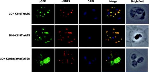 Figure 3. The K119TmATS-GFP and K60Tm(ama1)ATSs chimeric proteins associate with Maurer clefts. Immunofluorescence microscopy of trophozoite stage parasites from 3 different transgenic cell lines with αGFP and αSBP1 as a Maurer cleft resident marker. First image in each row represents the chimera detected with a rabbit αGFP antibody; the second displays the Maurer cleft protein, SBP1; the third DAPI staining of the nuclei; the fourth image is an overlay of all 3; and the last image represents a brightfield image of the infected RBC. First row, 3D7-K119TmATS parasites; second row, D10-K119TmATS parasites; third row, 3D7-K60Tm(ama1)ATSs parasites.