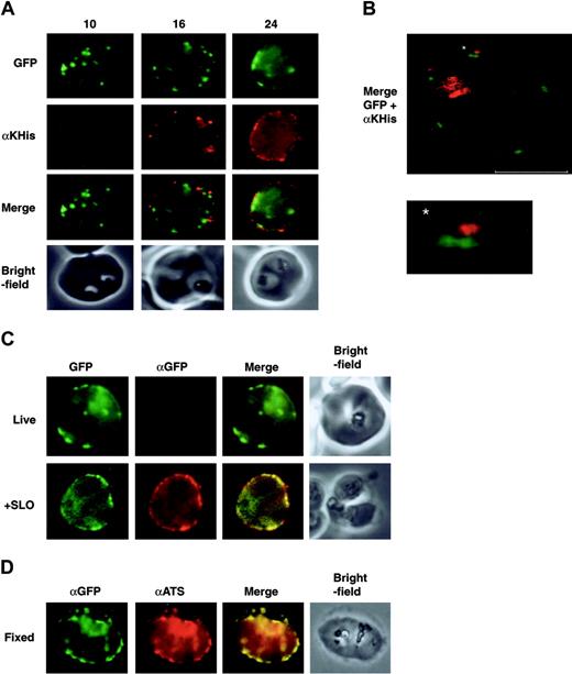Figure 4. Expression of a protein domain on the surface of P falciparum–infected RBCs. All panels display parasites expressing the 3D7-K119TmATS chimeric protein. The images are from synchronized cultures of transfectants at 10, 16, and 24 hours after invasion. (A) First row, GFP fluorescence; second row, live cells incubated with αKAHRP-His (αKHis) antibodies showing appearance of the KAHRP domain on the surface 16 hours after synchronization; third row, merge of rows 1 and 2; fourth row, bright-field images. (B) Confocal images of live 3D7-K119TmATS parasites 24 hours after invasion incubated with αKAHRP-His antibodies. The image shows an overlay of the GFP fluorescence (green) and αKAHRP-His labeling (red) for a single z section (0.3 μm). The bar equals 4 μm. The asterisk indicates the adjacent locations of GFP on the inside and KAHRP-His on the outside of the RBC plasma membrane, with an enlarged image below. The internal hemozoin-associated fluorescence represents partial reflection of the excitation beam and not labeling with the antibodies. (C) Control experiments examining the specificity of antibody labeling of intact cells. First column, GFP fluorescence; second column, αGFP; third column, overlay of fluorescence images; fourth column, brightfield image. The top row shows intact parasitized RBCs with no access of the αGFP to the GFP domain inside the cell. The bottom row represents a SLO-permeabilized cell where the antibody gains access to the domain on the inside of the RBC. (D) Formaldehyde-fixed parasites show accessibility to αATS and αGFP antibodies.