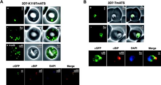 Figure 5. Trafficking of the K119TmATS-GFP protein is brefeldin A (BFA) sensitive. (Ai-ix) Live cells. GFP fluorescence (i,iv,vii); bright-field image (ii,v,viii); overlay (iii,vi,ix). Normal trafficking of the K119TmATS-GFP chimera was observed in the absence of BFA (-) or after washing, whereas BFA (+) treatment inhibited trafficking. (Ax-xiii) Immunofluorescence microscopy of fixed BFA-treated cells. (x) αGFP; (xi) αBiP; (xii) DAPI; (xiii) merge of subpanels x-xii. The chimera colocalizes with the ER marker BiP after incubation with BFA. (B) Brefeldin A treatment of 3D7-TmATS transfectants. (Bi-vi) Live cells in the presence (+) and absence (-) of BFA. GFP fluorescence (i,iv); phase-contrast images (ii,v); overlays (iii,vi). (Bvii-x) Immunofluorescence microscopy of fixed BFA-treated cells. (vii) αGFP antibody; (viii) αBiP antibody; (ix) DAPI; (x) merge of subpanels vii-ix.
