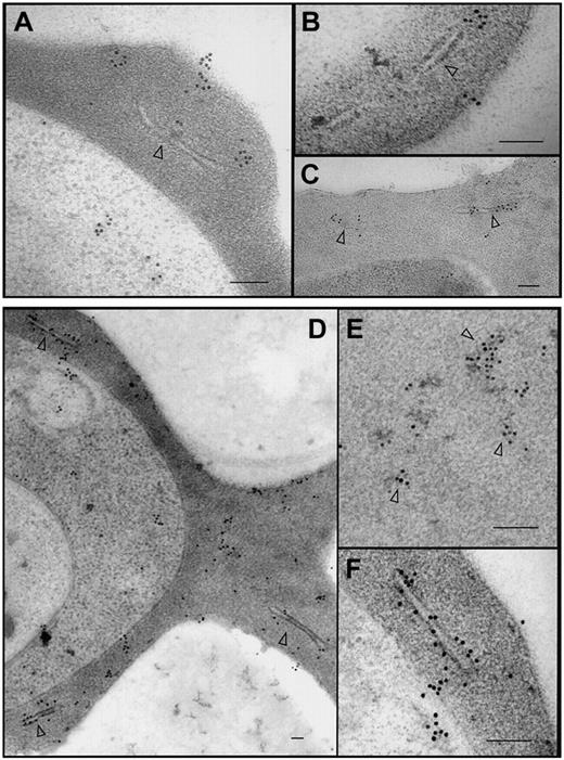 Figure 7. Subcellular localization and organization of PfEMP1-GFP. The 3D7-K60TmATSs-GFP (A-B), 3D7-K60Tm(ama1)ATSs-GFP (C), and 3D7-K119TmATS-GFP (D-F) transfectants were labeled with αGFP antibody. In each case the chimeric protein was observed within the parasite, in aggregates at and near Maurer clefts (arrowheads), and near the surface of the RBC. Gold particles were also often observed associated with electron dense aggregates in the red blood cell cytosol (D-E, arrowheads). Bars represent 100 nm.