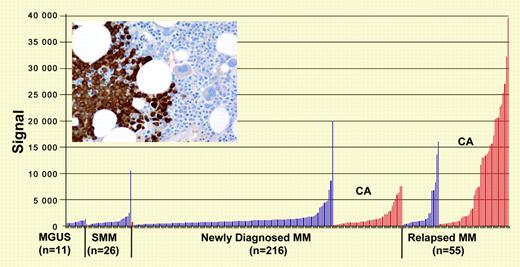 NY-ESO-1 gene and protein expression (inset: immunohistochemistry analysis of myeloma cells in bone marrow). See the related figures in the article beginning on page 3939.