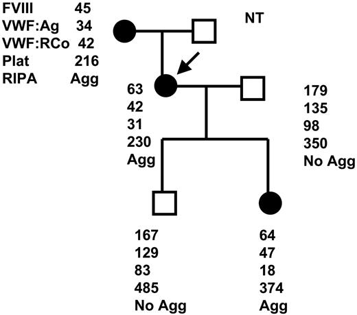 Figure 1. Pedigree of PT-VWD family. Affected members (•) and the unaffected members (□). The arrow indicates the propositus. Hemostatic data including FVIII (U/dL), VWF:Ag (U/dL), VWF:Ag RCoF (U/dL), platelet count (× 1000/mm2), and RIPA to 0.5 mg/mL are shown in order. Plat indicates platelet; Agg, aggregation.