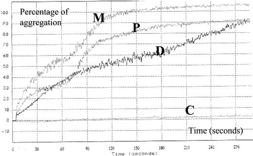 Figure 2. RIPA in patients with PT-VWD. Platelet aggregation in the presence of low concentration ristocetin (0.5 mg/mL) shows that the propositus (P), mother (M), and daughter (D) have a heightened response in comparison to lack of response of the control (C).
