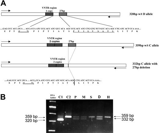 Figure 4. PCR analysis of the macroglycopeptide region of the GPIBA gene in 5 members of the PT-VWD family. (A) Schematic of macroglycopeptide region amplified in the PCR showing the position of the 27-bp deletion relative to the VNTR region (1 copy D allele). (B) Gel electrophoresis of PCR products from amplification of the macroglycopeptide region. A 100-bp ladder (200, 300, 400, 500, and 600 bp) is shown in lane 1. C1 is a normal control, homozygous for VNTR D allele (single 320-bp band). C2 is a normal control, homozygous for VNTR C allele (single 359-bp band). P, M, and D are the propositus, mother, and daughter, respectively, each with 2 bands representing the normal C allele (359 bp) and the C allele with the accompanying 27-bp deletion (332 bp). S and H refer to the healthy son and healthy husband, respectively, both of whom are homozygous for VNTR C allele and show a single 359-bp band.
