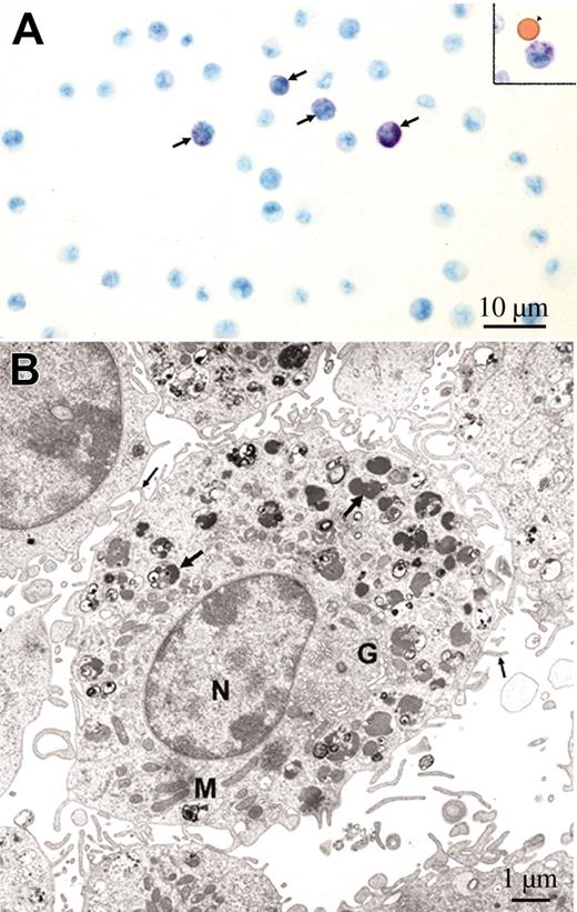 Figure 6. The AA4-/BGD6+ mast cells differentiate into mature mast cells in vitro. (A) Light microscopy of cells from cultures of AA4-/BGD6+ mast cells. After 4 weeks in culture many of the cells now contain granules (arrows) when stained with toluidine blue; magnification, × 750. Additionally, an occasional granulated cell can be seen still attached to an mAb-BGD6–conjugated magnetic bead (inset, arrow-head; magnification, × 880). Image was collected with an Olympus BX50 microscope equipped with a 60× UPLANFL objective (N.A. 1.25). (B) Electron microscopy of cells from cultures of AA4-/BGD6+ mast cells. By electron microscopy at 4 weeks, the cells from the culture of mast cell precursors have a morphology typical of cultured bone marrow–derived mast cells. Their surface is covered with thin microvilli (small arrow), and the cytoplasm contains a well-developed Golgi apparatus (G), numerous mitochondria (M), and cytoplasmic granules (large arrows) of varying density. N indicates nucleus. Magnification, × 4000.