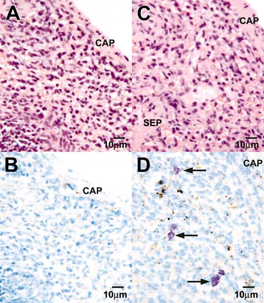 Figure 7. The AA4-/BGD6+ mast cells differentiate into mature mast cells in vivo. Light microscopy of a paraffin section of the spleen from a lethally irradiated mouse, hemotoxylin and eosin stained (A), or a serial section stained with toluidine blue (B). No mast cells can be seen. Light microscopy of a paraffin section of the spleen from a lethally irradiated mouse reconstituted with AA4-/BGD6+ mast cells stained with hemotoxylin and eosin (C) or toluidine blue (D). Mast cells with metachromatic granules (arrows) are preferentially present in the area adjacent to the capsule of the spleen. CAP indicates capsule; SEP, septum. Magnification, × 500. Image was collected with an Olympus BX50 microscope equipped with a 40× UPLANFL objective (N.A. 0.75).