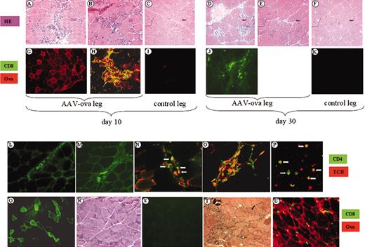 Figure 2. Histochemical and immunochemical analyses of skeletal muscle from DO11.10 TCR transgenic BALB/c mice. Muscle cross-sections were taken at day 10 (A-C,G-I,L,N) or day 30 (D-F,J,K,M,O) after intramuscular injection of AAV-CMV-OVA (1 × 1012 vg/mouse) from injected legs (A-B,D-E,G-H,J,L-O) and contralateral noninjected legs (C,F,I,K). Panels A-F represent muscle sections stained with hematoxylin and eosin (HE); panels G-K represent dual immunofluorescence stain for OVA (red stain, TRITC label) and CD8 (green stain, FITC label). Sections of injected leg muscle were also stained for IFN-γ–expressing cells (panel L, day 10, and panel M, day 30). Dual antibody stain for CD4 (green stain, FITC label) and DO11.10 TCR (red stain, TRITC label) are shown in panels N-P. Panels N and O are vector-injected muscle, days 10 and 30, respectively. Dual positive cells are shown by arrows in panels N and P, and are abundant in panel O. Panel P shows CD4/TCR stain on lymphocytes from DO11.10 TCR transgenic BALB/c mice. Original magnifications × 100 (A-K), × 200 (L-O), and × 400 (P). (Q-S) Muscle sections from animals 30 days after AAV-CMV-GFP (1 × 1012 vg/mouse) administration. GFP expression is shown for injected (Q) and contralateral noninjected (S) muscles. (R) Hematoxylin and eosin stain of AAV-CMV-GFP–injected muscle. (U-T) Muscle injected with AAV-C5/12-OVA, day 10 after gene transfer. Panel T is hematoxylin and eosin stain; panel U is immunofluorescence stain for CD8 (green) and OVA (red). Original magnification × 200 (Q-U).