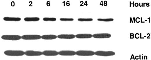 Figure 4. Effect of 8-Cl-Ado on expression of antiapoptotic proteins MCL-1 and BCL-2 in CLL lymphocytes. Immunoblot analysis was carried out for the expression of MCL-1 and BCL-2 proteins after incubating CLL lymphocytes with 10 μM 8-Cl-Ado with varying times. Actin was used as a loading control.