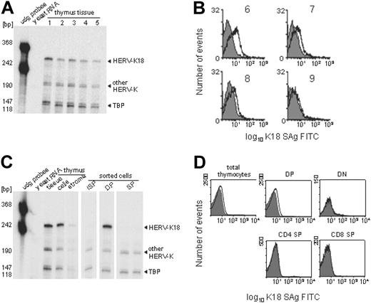 Figure 1. Constitutive HERV-K18 SAg expression restricted to thymocyte lineage. Thymic HERV-K18 expression was addressed by RPA and FACS analysis on total thymocytes and thymocyte subsets. (A) Shown is an RPA of whole thymus tissue from 5 donors using HERV-K18 SAg and human TBP control probes. The HERV-K18 SAg probe generates a full-length protected fragment from HERV-K18 transcripts and smaller internally digested fragments from other HERV-Ks. (B) Thymocyte suspensions from 4 donors (donors 6-9) were incubated with an isotype control (gray shaded curve) and with monoclonal antibodies against HERV-K18 (open curve), which were subsequently revealed by FITC-labeled secondary antibodies. (C) RPA was performed on whole thymus tissue, on single-cell suspensions, and on FACS-sorted samples. The cell fraction obtained after the elution of thymocytes is labeled stroma. Thymocyte suspensions were FACS sorted into the immediate precursors of DP cells (ISP = CD4+CD8-CD3-), into immature DP thymocytes (CD4+CD8+), and into mature SP thymocytes (CD4-CD8+, CD4+CD8-). (D) Freshly isolated thymocytes were labeled with isotype control antibodies (gray shaded curve) and monoclonal anti–HERV-18 antibodies (open curve). Gating on thymocyte subsets was based on CD4/CD8 expression, and exclusion of dead cells, which allowed to us address HERV-K18 expression of thymocyte subsets.