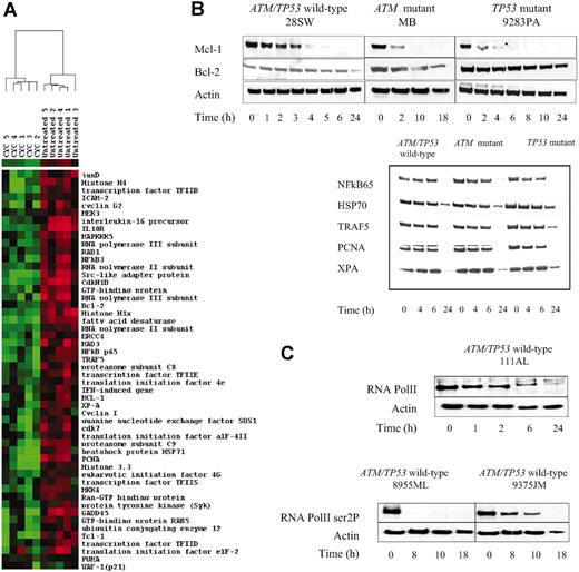 Figure 5. Effect of CYC202 on transcription and protein levels. Microarray analysis showing changes in expression of 52 selected genes in 5 B-CLL tumors following treatment with 5 μg/mL CYC202 for 4 hours. The cluster was visualized using TREEVIEW (http://www.microarrays.org/software.html). Columns represent individual B-CLL samples and rows correspond to genes. Color changes within a row indicate expression levels relative to the average of the same population: red = up-regulation, green = down-regulation. (B) Western blotting showing differential reduction in expression of antiapoptotic proteins, Mcl-1, Bcl-2, NFκB, HSP70, and TRAF 5, as well as proteins involved in repair (PCNA and XPA), in representative tumors of all 3 B-CLL subtypes following treatment with CYC202 for up to 24 hours. (C) Effect of CYC202 on RNA pol II in B-CLL. Western blotting with a phospho-specific antibody to serine 2 of the carboxy-terminal domain of RNA pol II showing down-regulation of RNA pol II phosphorylation after CYC202 treatment with 5 μg/mL of 2 ATM/TP53 wild-type B-CLL tumors (bottom panel). Western blotting showing down-regulation of total RNA pol II protein levels by 24 hours of CYC202 treatment in a representative ATM/TP53 wild-type B-CLL tumor (top panel).