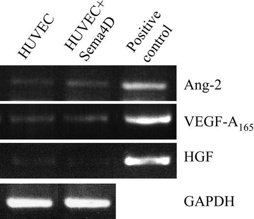 Figure 4. Sema4D stimulation does not up-regulate the expression of angiopoietin-2, VEGF-A, or HGF. mRNAs extracted from unstimulated (first lane) and Sema4D-stimulated (second lane) HUVECs, were retrotranscribed and amplified for the angiopoietin-2 (Ang-2), VEGF-A, and HGF transcripts (see “Materials and methods”). Plasmid DNA (third lane) was used as positive control. No increase in expression of these genes was observed on Sema4D stimulation. Glyceraldehyde-3-phosphate dehydrogenase (GAPDH) amplification was performed as a control for all the extracted RNAs. No differences were observed; one of these controls is shown.