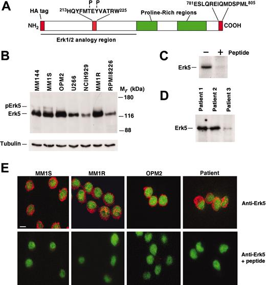 Figure 1. Expression of Erk5 in myeloma cells. (A) Schematic representation of Erk5, with the epitopes recognized by the anti-Erk5 (C-terminal), anti-pErk5, and anti-HA antibodies. (B) Expression of Erk5 in MM cell lines. Erk5 was immunoprecipitated from 1-mg cell extracts and detected by Western blotting with the anti–C-terminus antibody. The position of the Mr markers is indicated at the right. In parallel, and as a loading control, 20 μg protein from each of the cell extracts was analyzed for tubulin content by Western blotting. (C) Specificity of the anti-Erk5 antibody; 1 mg MM1S cell extracts was immunoprecipitated with the anti-Erk5 C-terminus antibody either in the absence or presence of 10 μg of the peptide used to raise the antibody. Erk5 was detected by Western blotting as described in panel B. (D) Expression of Erk5 in patient myeloma cells. Cells were isolated from myeloma patients, plated in complete media, and analyzed by Western blotting for Erk5. The proportion of malignant plasma cells was greater than 90% as indicated by phenotypic analysis before the experiment. (E) Immunofluorescent localization of Erk5 in myeloma cells. Cells were plated on poly-l-lysine–coated coverslips and immunostained with the anti-Erk5 C-terminal antibody that was previously preincubated with the antigenic peptide, where indicated. Erk5 is shown in red, together with a nuclear stain (SYBR green). Bar represents 10 μm.