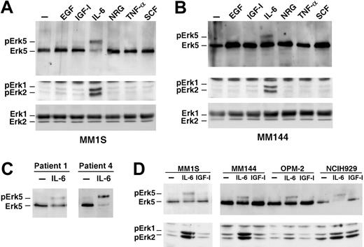 Figure 2. IL-6 activates Erk5 in myeloma cells. MM1S (A) or MM144 (B) cells were incubated for 10 minutes with 10 nM EGF, IGF-1, IL-6, NRG, TNF-α, or SCF, and Erk5 expression was analyzed by Western blotting. The action of the polypeptide factors on Erk1/2 phosphorylation was detected by Western blotting with anti-pErk1/2 antibodies, and the total amount of Erk1/2 was analyzed on cell extracts with an anti-Erk1/2 antibody. (C) Effect of IL-6 on patient myeloma cells. Cells were treated with IL-6 as described in panel A and Erk5 analyzed by Western blotting from anti-Erk5 immunoprecipitates. (D) Cells were serum-starved for 18 hours and then treated with IGF-1 (10 nM) or IL-6 (5 nM) and Erk5 and pErk1/2 were analyzed by Western blotting.