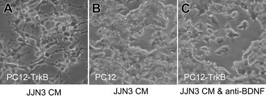 Figure 2. Malignant plasma cells secrete functional BDNF. Media conditioned by HMCL JJN3 triggers neurite outgrowth by TrkB-expressing PC12 cells (PC12-TrkB) (A) but not by parental PC12 cells, which lack TrkB (B) and not by PC12-TrkB in the presence of neutralizing anti-BDNF antibody (C).