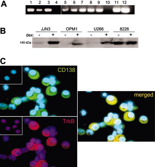 Figure 3. Expression of TrkB by MM. (A) RT-PCR demonstrating TrkB mRNA expression by 8 of 9 HMCLs (lanes 1-9) and by 2 primary MM samples (lanes 11-12) but not by a Waldenstrom cell line (lane 10). No PCR products were evident in the absence of RT (not shown). HMCLs were (1) NCI H929, (2) LP1, (3) RPMI 8226, (4) ARP1, (5) U266, (6) OPM1, (7) UTMC2, (8) KMS11, and (9) JJN3. (B) Western blot of whole-cell lysates stained with anti-Trk (C-14), demonstrating TrkB expression by 4 HMCLs. RPMI 8226 constitutively express TrkB, whereas JJN3, OPM1, and U266 express TrkB after 24-hour exposure to 100 nM dexamethasone. (C) Immunofluorescence demonstrating TrkB expression by primary MM plasma cells. Representative cytospins of BM mononuclear cells freshly isolated from a patient with MM and stained with antibodies to TrkB (rhodamine) and CD138 (FITC). CD138+ plasma cells show strong immunoreactivity for TrkB, seen in the merged image. (Insets) No staining is evident when nonimmune rabbit IgG (for TrkB) or mouse IgG (for CD138) are used as primary antibodies.