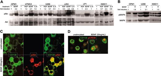 Figure 5. Expression of functional TrkB by MM: intracellular signaling in response to BDNF. (A-B) BDNF triggers phosphorylation of Akt and MAPK by HMCL. HMCLs were serum starved overnight, exposed to ligand for 5 minutes at 37°C, and lysed. Whole-cell lysates were subjected to SDS-PAGE, blotted, and probed with antibodies specific to Akt, phosphoAkt, MAPK, or phosphoMAPK. Blots were developed with ECL, and the resulting images were scanned and analyzed using Scion Image for Windows (Frederick, MD). The density of each phosphospecific band was corrected for variance in loading, using the density of the corresponding nonphosphorylated band. The fold induction was then calculated as the ratio of densities between stimulated and unstimulated phosphorylated protein. (A) BDNF triggers phosphorylation of Akt in HMCL. The ability of NGF (100 ng/mL), BDNF (50 ng/mL), or IL-6 (100 ng/mL) to activate PI3K/Akt signaling in HMCL was assessed using antibodies specific to Akt and phosphoAkt. (B) BDNF triggers phosphorylation of MAPK in HMCL. Antibodies specific to MAPK and phosphoMAPK p42/44 were used to assess activation of Ras/Raf/MEK signaling by BDNF (50 ng/mL) in HMCLs OPM1, U266, and KMS11. (C-D) BDNF triggers phosphorylation of Akt and CREB in primary MM cells. BM mononuclear cells were stimulated for 10 minutes at 37°C with BDNF (50 ng/mL), spun onto microscope slides, and stained for CD138 (FITC) and phosphoAkt (rhodamine), or CD138 (FITC) and phosphoCREB (rhodamine). (C) Akt phosphorylation by primary MM. CD138+ cells (green) stain for cytoplasmic phosphoAkt (red) after stimulation with BDNF (merged image is yellow). (D) CREB phosphorylation by primary MM. CD138+ cells (green) show nuclear localization of pCREB (red) after stimulation with BDNF.