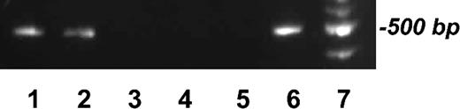 Figure 3. Analysis of F-MuLV integration within the host genome. Genomic DNA from LDSACs (1), leukemic suspension cells (2), HDSACs (3), normal suspension cells (4), NIH-3T3 cells as negative control (5), HB60 leukemic cells as positive control (6), and 1 kbp ladder (7) was extracted. Friend virus env primers were used to amplify the integration site of the virus's env as described in “Materials and methods.”