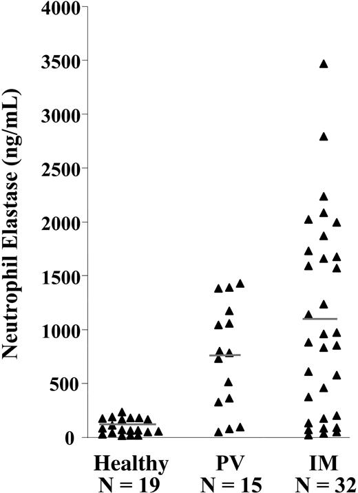 Figure 1. NE levels in the plasma of patients with IM. The levels of NE in the plasma of healthy subjects (n = 19), patients with PV (n = 15), and patients with IM (n = 32) were assayed by ELISA. Each point represents the mean of the concentration of NE in each individual plasma sample assayed in duplicate. The bars represent the mean of each sample group. The levels of NE in the plasma of healthy control subjects were significantly less than that of both patients with IM (P < .001) and patients with PV (P < .01). There was no significant difference between the levels of NE in plasma from patients with IM and PV (P > .05).
