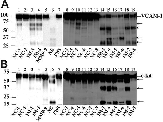 Figure 5. Media conditioned by IM MNCs have a greater ability to cleave VCAM-1 and c-kit. (A) MNCs were incubated in serum-free IMDM at 37°C and 5% CO2 for 24 hours. Recombinant rhuVCAM-1 was incubated for 15 minutes at 37°C in the presence of medium conditioned by PB mononuclear cells from either healthy volunteers (n = 8) or patients with IM (n = 8) or in the presence of purified human NE, MMP-9, or PBS. Following preincubation, samples were analyzed by Western blot with a goat anti–human VCAM-1 antibody. The arrows represent the fragments of the extracellular domain of VCAM-1. (B) Purified extracellular domains of rhuc-kit was incubated at 37°C for 6 hours in the presence of medium conditioned by PB mononuclear cells from either healthy volunteers (n = 8) or patients with IM (n = 8) or in the presence of purified human NE, MMP-9, or PBS. Following preincubation, samples were analyzed by Western blot with a goat anti–human c-kit antibody. The arrows represent the fragments of the extracellular domain of c-kit.