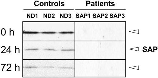 Figure 1. Regulation of SAP expression in CD8+ T cells. Western blot analysis of SAP expression in CD8+ T cells from healthy donors (ND1, ND2, and ND3), and patients with HLH (SAP1) and XLP (SAP2 and SAP3) at a resting state and at 24 or 72 hours after activation with 10 μg/mL immobilized anti-CD3 mAbs.