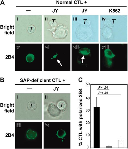 Figure 4. Distribution of 2B4 in normal and SAP-deficient CD8+ T cells. (A) 2B4 distribution in normal CD8+ CTLs (T) either alone or at the contact with EBV+/CD48+ JY B cells or EBV-/CD48-K562 cells. Representative cells are shown as bright field (i-iv) and 2B4 staining (v-viii). The white arrows indicate 2B4 clustering at the cell contact area. (B) 2B4 distribution in SAP-deficient CD8+ T cells either alone or at the contact with EBV+/CD48+ JY B cells. Representative cells are shown as bright field (i-ii) and 2B4 staining (iii-iv). (C) Quantitative analysis of the percentage of CTLs (normal or SAP deficient) with clustered 2B4 at the cell contact area. ▪ indicates normal CTL + JY; ▦, normal CTL + K562; and □, SAP-deficient CTL + JY cells. Mean percentages (± SDs) of 3 experiments counting T cells forming clusters with single target cells (100 conjugates were counted). Statistical analysis was performed using an unpaired t test, and P values corresponding to the comparison of 1 group with the other are indicated.