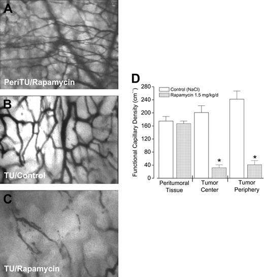 Figure 3. Rapamycin treatment induces the selective shutdown of initially functional tumor vessels. The effect of a 3-day rapamycin treatment (1.5 mg/kg/d) schedule on the functional capillary density (FCD) of normal and CT-26 tumor (TU) tissue (day 11 after tumor implantation) are shown. Intravital microscopy views of (A) peritumoral vessels, (B) a normal tumor vessel network in control mice, and (C) significant loss of FCD in the tumor of a rapamycin-treated animal. (D) A computer-assisted quantitative analysis of blood vessels demonstrates a significant loss of FCD after rapamycin treatment in the peripheral and central tumor region compared to untreated tumors or compared to peritumoral tissue. □ indicates saline control mice; ▦, mice treated with 1.5 mg/kg/d rapamycin. Data shown are mean values ± SEM of 7 mice per group. *P < .05 versus saline control. Total magnification in panels A-C, 630×, 20× Leitz Wetzlar long-distance objective lens, numerical aperture 0.32. Images were acquired with Image J software.
