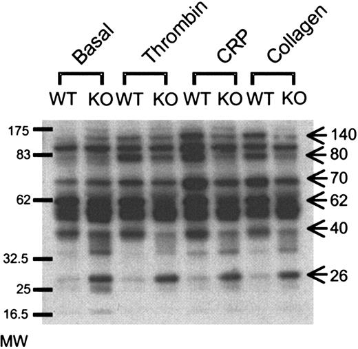 Figure 2. Absence of GATA1 leads to differential protein tyrosine phosphorylation. Platelets from wild-type (WT) and ΔneoΔHS (KO) mice were aggregated with thrombin (1.0 U/mL), collagen (10 μg/mL), or CRP (10 μg/mL) prior to lysis with 2 × Lysis buffer. Proteins were separated on SDS-PAGE, using 4% to 12% precast gradient gels, transferred onto PVDF membranes, and blotted with anti-phosphotyrosine Ab, 4G10. Bands of interest are highlighted by arrows, including a constitutively tyrosine phosphorylated band at approximately 26 to 28 kDa, and phosphorylated proteins at 40, 62, 70, 80, and 140 kDa. Molecular weight (MW) markers are provided on the left-hand side.