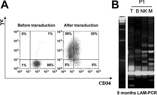 Figure 1. CD34+ cell transduction and LAM-PCR analysis of peripheral leukocyte subsets. (A) γc expression on P1 CD34+ cells before and after transduction. (B) LAM-PCR analysis of the vector insertion site restriction length polymorphism present in peripheral blood leukocytes of P1. DNA samples of approximately 1 to 50 ng isolated directly from sorted peripheral blood leukocytes were analyzed at 6 months after gene therapy. Prominent bands in all lanes at the bottom of the gel are internal PCR controls. Left lane shows 100 bps DNA marker; other lanes: T, CD3+ cells; B, CD19+ cells; NK, CD16/56+ cells; and M, CD33+ myeloid cells.