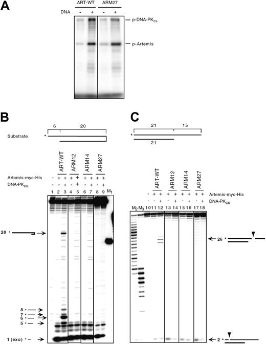 Figure 5. In vitro function of ARTEMIS mutants. (A) DNA-PKcs assay of ARTEMIS and ARTEMIS mutants. Wild-type ARTEMIS and mutant ARTEMIS ARM27 were subjected to a DNA-PKcs phosphorylation assay in the absence and presence of exogenous 35 bp DNA. The positions of phosphorylated DNA-PKcs (p-DNA-PKcs) and phosphorylated ARTEMIS (p-ARTEMIS) are indicated. The ARTEMIS mutant ARM27 is indistinguishable from wild-type ARTEMIS in the ability of being phosphorylated by DNA-PKcs. (B) In vitro nuclease assay of ARTEMIS and ARTEMIS mutants. To analyze 5′ overhang processing and hairpin opening activities of ART-WT, ARM27, ARM12, and ARM14, a 20-bp hairpin with a 6 nt 5′ overhang was used as the substrate. The asterisks indicate the positions of the radioactive label. Wild-type ARTEMIS and mutant ARTEMIS proteins were incubated with the substrate indicated in the absence and presence of DNA-PKcs. Autoradiographs of sequencing gels are shown. M1 marks the position of the hairpin opening product if the hairpin was opened at the tip. Positions and sizes of the major hairpin opening and overhang processing products are indicated by arrows and numbers (in nt). The exonucleolytic product by ARTEMIS (1 nt) is indicated by “exo” adjacent to the size of the product. Diagrams adjacent to the arrows are depicted to show the cleavage positions in the substrate that result in the corresponding products. (C) A 21-bp DNA with a 15 nt 3′ overhang was used as the substrate. The asterisks indicate the positions of the radioactive label. Diagrams adjacent to the arrows are depicted to show the cleavage positions in the substrate that result in the corresponding products. M2 and M3 were generated by incubating the labeled strand of the 3′ overhang substrate with Klenow enzyme at room temperature for 30 and 60 minutes, respectively.
