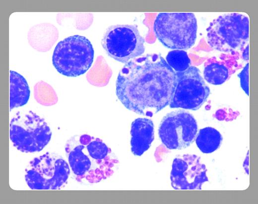 John Lazarchick and Bart McRae, Medical University of South Carolina