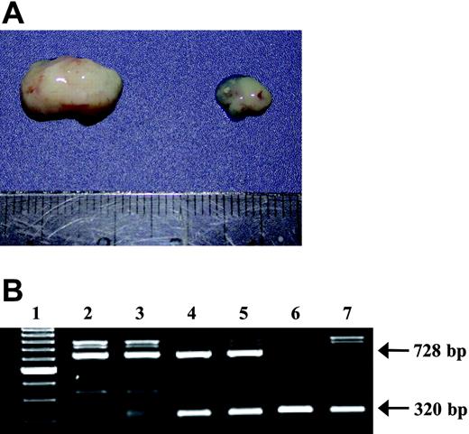 Figure 2. Absence of L-selectin on lymphoma cells prevents their growth in the thymuses of normal, but not L-selectin-deficient, C57BL/6 mice. (A, left) Representative thymic lymphoma harvested at necropsy after the injection of normal lymphoma or of L-selectin-deficient lymphoma to L-selectin-deficient mice. (Right) Thymus representative of a C57BL/6 mouse injected with L-selectin-deficient lymphoma after the same period of latency. (B) Genotype of thymic lymphoma cells induced on the intrathymic injection of lymphoma cells. Thymic lymphomas were harvested, and their genomic DNA was analyzed using the same primers as those used in Figure 1. Lane 1, 100-bp ladder; lane 2, thymic lymphoma harvested from normal C57BL/6 mice injected with 267 cells; lane 3, L-selectin-deficient C57BL/6 mice injected with 267 cells; lane 4, C57BL/6 mice injected with 1681 cells; lane 5, L-selectin-deficient C57BL/6 mice injected with 1681 cells; lane 6, L-selectin-deficient C57BL/6 mice injected with KOL1682 cells; lane 7, L-selectin-deficient C57BL/6 mice injected with KOL1677 cells.
