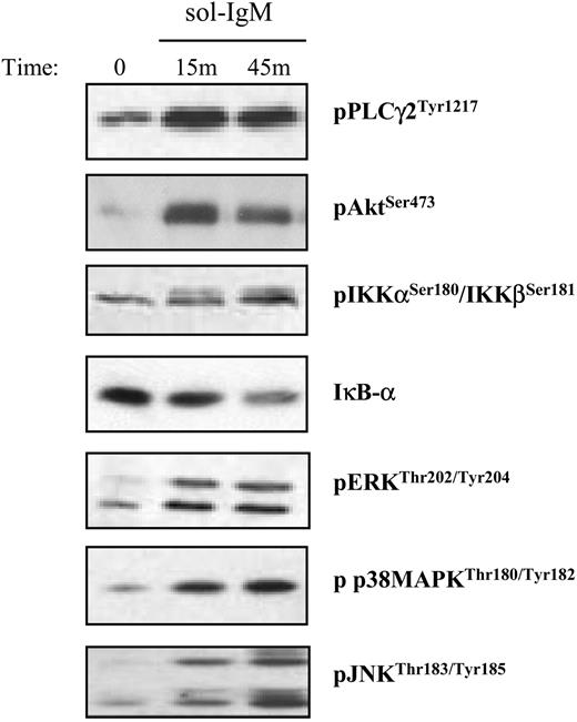 Figure 1. Activation of downstream BCR signaling pathways after stimulation with sol-IgM. CLL B cells were stimulated with sol-IgM for the indicated times, lysed, and immunoblotted as described in “Patients, materials, and methods.” Immunoblots show examples of typical positive cases.