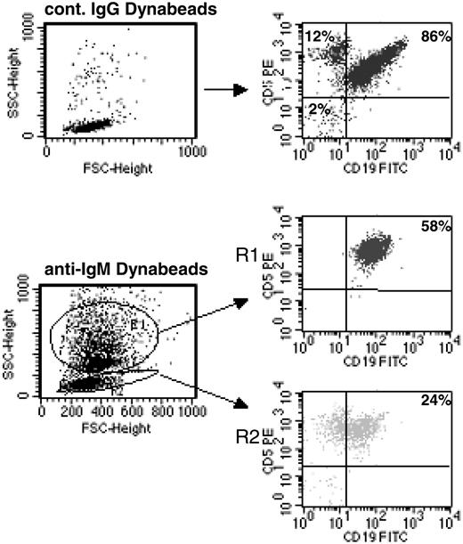 Figure 2. Continuous BCR stimulation of CLL B cells by imm-IgM. CLL B cells were analyzed by flow cytometry after 48 hours in culture with Dynabeads coated with control goat IgG (top panels) or anti-human IgM (bottom panels). Cells bound with Dynabeads have a different side scatter (SSC) and are present in region R1; unbound cells remain in R2. The percentage of CD5+CD19+ CLL B cells is indicated for each region. FSC indicates forward scatter.