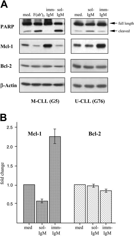 Figure 5. Opposing effects of sol-IgM and imm-IgM on PARP cleavage and Mcl-1 expression. (A) CLL B cells were stimulated for 40 hours with sol-IgM (10 μg/mL), sol-F(ab′)2 fragments (5 μg/mL), or imm-IgM (10 μg/mL). Protein extracts were analyzed by immunoblotting with antibodies against PARP, Mcl-1, Bcl-2, and β-actin. Two representative cases are shown. (B) Summary of changes in Mcl-1 (dark bars) and Bcl-2 (light bars) protein levels after 40-hour stimulation of CLL B cells with sol- and imm-IgM. For quantification, band intensities were first normalized to the respective actin signal and then calculated as fold change relative to unstimulated CLL B cells, which was set to 1.0. Values represent mean of 10 different cases (5 M-CLL, 5 U-CLL); error bars indicate SEM. Med indicates medium.