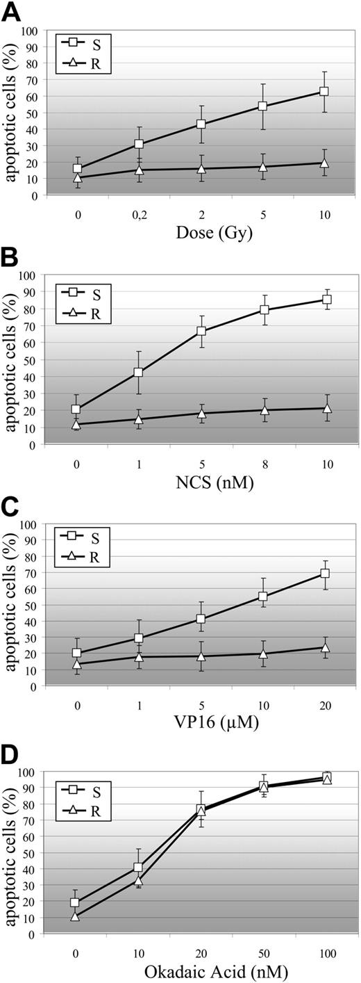 Figure 1. B-CLL cell sensitivity to DSB-induced apoptosis. R indicates resistant B-CLL cells; and S, sensitive B-CLL cells. (A) Sensitivity of B-CLL cells to γ-irradiation-induced apoptosis (R: n = 13 samples; S: n = 79 samples). Sensitivity of R (n = 5 samples) and S (n = 15 samples) B-CLL cells to NCS-induced (B), VP16-induced (C), and okadaic acid-induced (D) apoptosis. Percentages of apoptotic cells are the means (± SEM) of duplicate experiments on B-CLL samples.