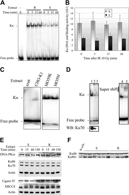 Figure 5. Constitutive increase in Ku70/80 heterodimer DNA-end binding activity. (A) Ku DNA-end binding activity in whole protein extracts from resistant (R) and sensitive B-CLL (S) cells (1 μg/lane) at the indicated times after treatment with 10 Gy γ-irradiation. The results shown are representative of those obtained in all extracts tested (n = 3 for resistant samples and n = 3 for sensitive samples). (B) Ku DNA-end binding activity (mean ± SEM in arbitrary units, AU) in 3 resistant B-CLL samples (R) and 3 sensitive B-CLL samples (S) at the indicated times after irradiation. (C) Untreated whole cell protein extracts (1 μg/lane) from the Ku80-deficient xrs6 cell line and the CHO-K1 line (expressing both Ku70 and Ku80 proteins). MO59J (DNA-PKcs deficient) and MO59K (normal levels of DNA-PKcs activity) were used as controls. (D) Untreated B-CLL lymphocyte protein extracts (5 μg, lane 1) were immunodepleted using 125 ng (lane 2) and 250 ng (lane 3) monoclonal Ku70 antibody, assayed for Ku DNA-end binding activity (1 μg protein extract/lane) (upper panel) and then subjected to Western blot (WB) analysis (lower panel). For supershift assays (lanes 4-5), samples were treated with 5 μg untreated B-CLL lymphocyte protein extract (lane 5) or with 250 ng polyclonal Ku70 antibody (lane 4), and then assayed for Ku DNA-end binding (1 μg of protein extract/lane). (E) Whole-cell extracts (5 μg) were obtained from representative sensitive and resistant B-CLL cell samples at the indicated times after irradiation. Extracts were subjected to electrophoresis on a 10% SDS polyacrylamide gel (DNA-PKcs analysis was carried out using a 6% SDS polyacrylamide gel). Proteins were then blotted onto polyvinylidenefluoride (PVDF) membranes and were detected using the appropriate antibodies. (F) Whole-cell extracts (5 μg) from 6 sensitive (S) and 4 resistant (R) untreated B-CLL cell samples, and 4 untreated normal B-cell samples from healthy donors (B cells) were subjected to Western blotting analysis as described in panel E. See Supplemental Figure S3 for more information.