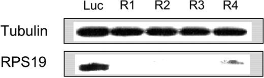 Figure 1. shRNA retroviruses decrease expression of RPS19. The effect of RPS19 shRNA retroviruses on RPS19 protein levels was evaluated by Western blot.