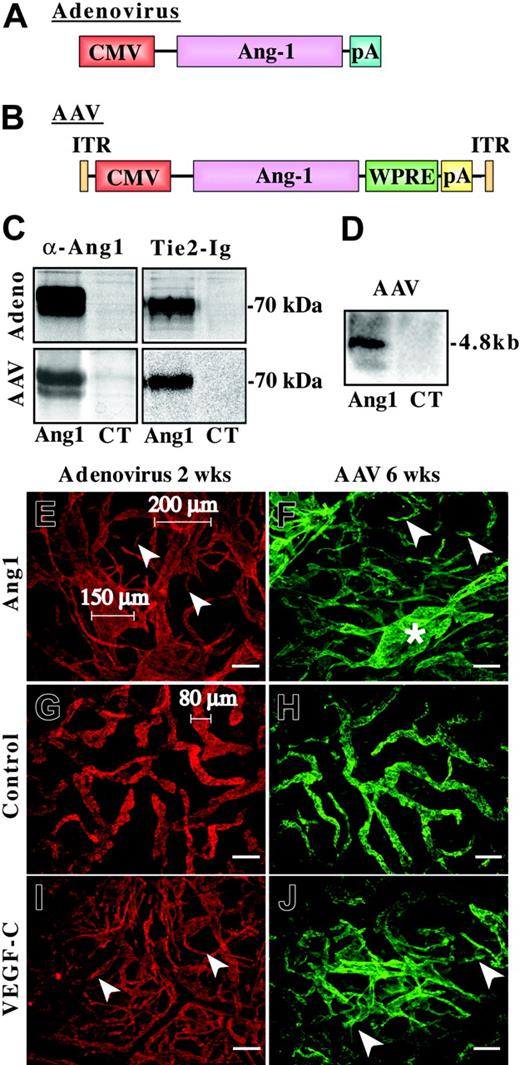 Figure 1. Viral Ang1 vectors and their effects on lymphatic vessels. (A-B) Schematic structures of the viral Ang1 constructs used in the study. (A) The adenoviral Ang1 vector.29 (B) The AAV vector containing the full-length human Ang1 cDNA. CMV indicates cytomegalovirus promoter and early enhancer; WPRE, Woodchuck hepatitis virus posttranscriptional enhancer element; pA, polyadenylation signal (from Simian virus 40); and ITR, inverted terminal repeats. (C) Comparison of AdAng1 and AAV-Ang1 recombinant protein production in vitro by precipitation using Ang1 antibodies or soluble Tie2-Fc protein. Media from AdLacZ- and AAV-EGFP-infected cells were used as negative controls (CT). (D) Ang1 RNA expression in a Northern blot containing total RNA from mouse ears 6 weeks after infection with AAV-Ang1 or AAV-EGFP. (E,G,I) Lymphatic vessels visualized with fluorescent LYVE-1 (red) whole-mount staining 2 weeks after infection with the adenoviruses. Lymphatic sprouts are indicated with arrowheads in panels E and I. (G) Lymphatics after AdLacZ infection. (F,H,J) LYVE-1-stained lymphatic vessels (green) in ears 6 weeks after AAV transduction. Ang1-induced lymphatic enlargement is shown with an asterisk in panel F. Scale bars: 100 μm.