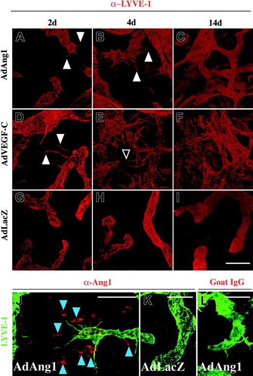 Figure 2. Changes in cutaneous lymphatic vessels after adenoviral transduction. (A-I) The vessels were stained for LYVE-1 (red). Sprouts formed by adenoviral Ang1 or VEGF-C are indicated with arrowheads in panels A, B, and D. Fusion of individual sprouts 4 days after AdVEGF-C administration is shown with an open arrowhead in panel E. At the 14-day time point, a dense network of lymphatic vessels can be seen in both Ang1- and VEGF-C-treated ears (C,F). (G-I) Lymphatic vessels after AdLacZ transduction. (J-K) Staining of Ang1 (red) and LYVE-1 (green). Localization of Ang1 positive cells (blue arrowheads) and lymphatic sprouts in the ear transduced with AdAng1 (J). AdLacZ-transduced (K) and AdAng1-transduced goat IgG-stained controls (L) are shown for comparison. Scale bars: 100 μm.