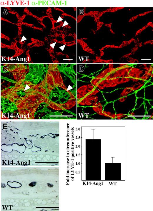 Figure 3. Lymphatic capillary hyperplasia in K14-Ang1 transgenic mice. (A-B) Lymphatic vessels in the ear of a K14-Ang1 transgenic mouse (A) and littermate control (B) whole-mount-stained with antibodies to LYVE-1. Note lymphatic vessels around hair follicles (arrowheads). (C-D) Double staining of lymphatic (red) and blood vessels (green). (E) Quantitative analysis of the circumference of LYVE-1-stained lymphatic vessels in ear sections (see micrographs to the left of the graph) of K14-Ang1 transgenic mice relative to controls. Bars represent mean values ± SD (n = 3) and P < .01 compared with wild-type (WT) controls. Scale bars: 100 μm.