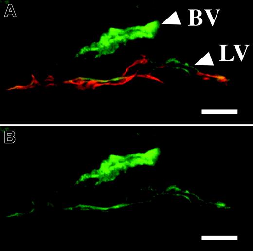 Figure 4. The Tie2 receptor is expressed in the lymphatic vessels. (A-B) Immunofluorescence for Tie2 (green) in blood vessels (BV) and lymphatic vessels (LV). (A) Double staining for LYVE-1 (red) and Tie2. Scale bars: 10 μm.