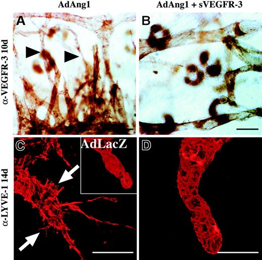 Figure 5. Lymphatic vascular effects of Ang1 are inhibited by systemic delivery of adenoviruses encoding the VEGFR-3-Ig fusion protein. (A-B) Anti-VEGFR-3-stained lymphatic vessel sprouts 10 days after transduction of AdAng1 (arrowheads in A) or AdAng1 plus systemic (s) AdVEGFR-3-Ig (B). (C-D) Confocal imaging of LYVE-1-stained lymphatic capillary ends 14 days after AdAng1 administration. Filopodia formed in response to AdAng1 treatment are indicated with arrows in panel C, while no filopodia can be seen in the AdAng1 plus AdVEGFR-3-Ig-treated ears (D). (C inset) A lymphatic vessel after AdLacZ transduction. Scale bars: 100 μm.