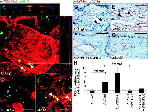 Figure 6. Ang1 induces proliferation of lymphatic endothelial cells. (A-C) Double staining of VEGFR-3 (red) and the proliferation marker phosphohistone H3 (green) 14 days after adenovirus transduction. Double-positive cells (arrowheads) are identified from confocal stacks by X and Y projections (white arrows). (D-G) PCNA/LYVE-1 double staining of ears from mice treated with the indicated adenoviral vectors. PCNA-positive LEC nuclei have been marked with arrowheads in panels D and E. (H) Quantification of the proportion of PCNA plus LYVE-1 double-positive cells relative to AdLacZ-negative control samples. Bars represent mean values ± SEM (n ≤ 3). Scale bars: 100 μm.