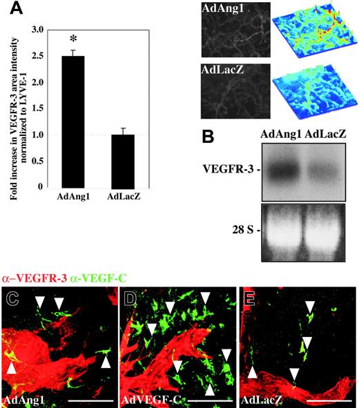 Figure 7. Adenoviral Ang1 up-regulates the expression of VEGFR-3 in vivo and in vitro. (A) Quantification of VEGFR-3-stained immunofluorescent area intensities, normalized to LYVE-1 staining intensities, in ears transduced with either AdAng1 or AdLacZ. The 2.5-fold increase in VEGFR-3 levels on the lymphatic endothelium 4 days after gene transduction was statistically significant (*P < .001). The horizontal broken line indicates the baseline of VEGFR-3 expression in the control samples. Images and surface plots above panel B show changes in VEGFR-3 staining intensity after AdAng1 transduction compared with control. Bars represent mean values ± SEM (n ≤ 5). (B) Northern blot of total RNA extracted from LECs and BECs transduced with either AdAng1 or AdLacZ. (C-E) Double immunofluorescent staining of VEGFR-3 (red) and VEGF-C (green) in the ears 2 weeks after transduction with AdAng1 (C), AdVEGF-C (D), or AdLacZ (E). VEGF-C-positive cells are indicated with arrowheads. Scale bars: 100 μm.