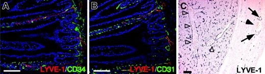 Figure 2. LYVE-1 expression in LECs and liver sinusoids. Immunostaining with ALY7 in tissue sections (A-B). Cross-sections were prepared from intestines of adult mice and stained with ALY7 (red color in panels A-B), CD34 mAb (green color in panel A), and CD31/PECAM-1 mAb (green color in panel B). Note that all LYVE-1+ cells are also CD31+ but CD34-. (C) Cross-sections were prepared from liver of E14 embryos and stained with ALY7. Note that ALY7 specifically detects lymphatic vessels (arrows) but not blood vessels (arrowheads). ALY7 also detects sinusoid blood vessels in liver (open arrowheads). Scale bars indicate 100 μm.