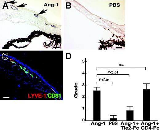Figure 6. In vivo lymphatic vessel formation in mouse cornea induced by COMP-Ang-1. (A) ALY7 immunostaining of lymphatic vessels of the cornea. COMP-Ang-1-induced migrated endothelial cells on the cornea show positive LYVE-1 immunoreactivity (arrows), indicating that lymphatic vessels were induced by COMP-Ang-1. (B) No obvious LYVE-1+ lymphatic vessel is seen on the cornea with a pellet containing PBS alone. (C) Double-staining of newly formed vessels with ALY (red) and anti-CD31 (green) antibodies. Both of the lymphatic (merged) and blood vessel (green) endothelial cells migrated into the cornea induced by the pellet containing COMP-Ang-1. (D) Quantitative estimation of corneal lymphangiogenesis by immunostaining with ALY7. The lymphangiogenic grading score was determined by a previously described method.10 Recombinant soluble Tie2-Fc protein suppressed the COMP-Ang-1-induced lymphatic vessel formation on mouse cornea, whereas soluble CD4-Fc protein could not inhibit corneal lymphangiogenesis. The graphs represent the mean ± SEM (n = 6); scale bars indicate 50 μm.