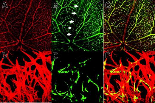 Figure 4. GFP- ECs in the VECDp-5′ Int1- egfp. Flat-mount specimen of a retina of an 8-week-old VECDp-5′ Int1-egfp transgenic mouse was stained with (A) anti-PECAM-1 mAb (red) (B) anti-GFP antibody (green). Arrows indicate a venous trunk in this retina, in which GFP expression was not detected. (C) Overlay. In one experiment (C-D), neo-angiogenesis was induced in the cornea of this transgenic strain. Whole-mount specimen of a newly formed vascular plexus was stained by (D) anti-PECAM-1 mAb (red) and (E) anti-GFP antibody (green). (F) Overlay. Only portions of ECs in this region are GFP+, and they are distributed randomly.